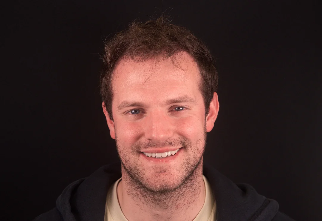 Carillas de Porcelana - Antonio 4 Carillas de Porcelana - Antonio 4