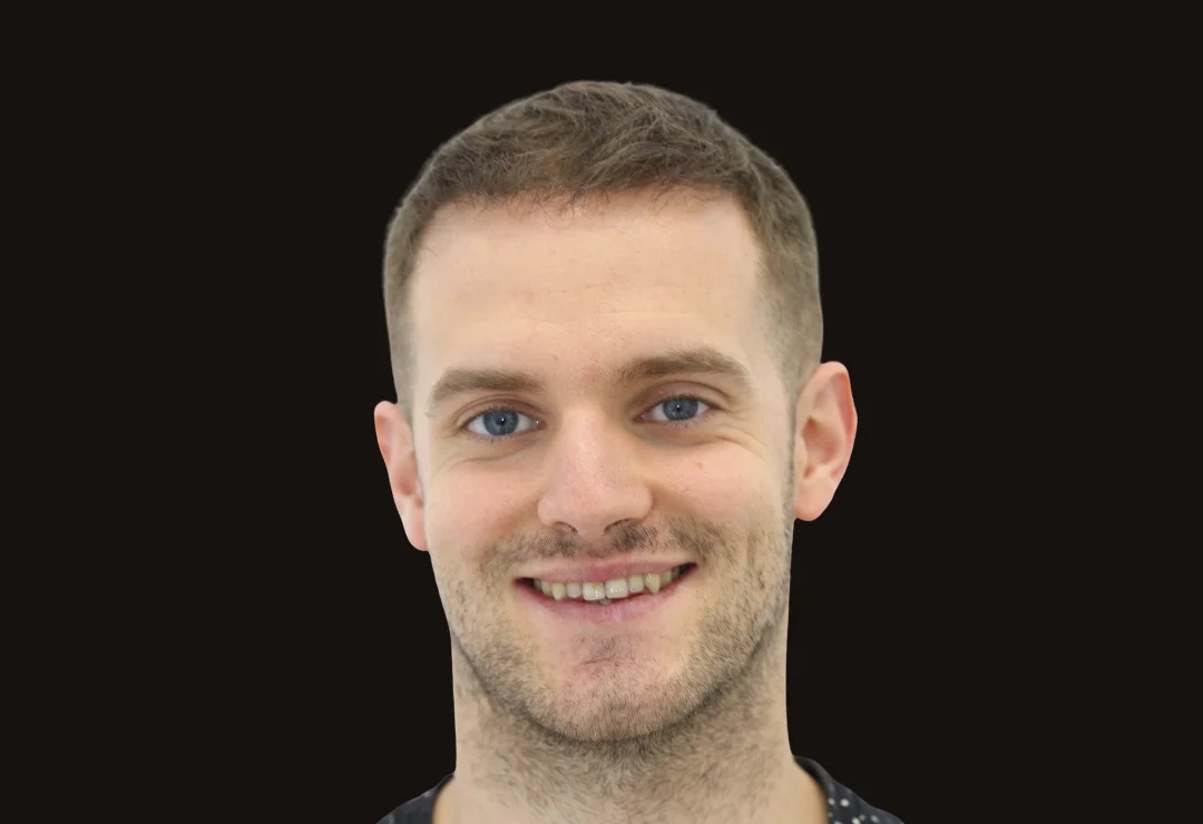 Carillas de Porcelana - Antonio 3 Carillas de Porcelana - Antonio 3