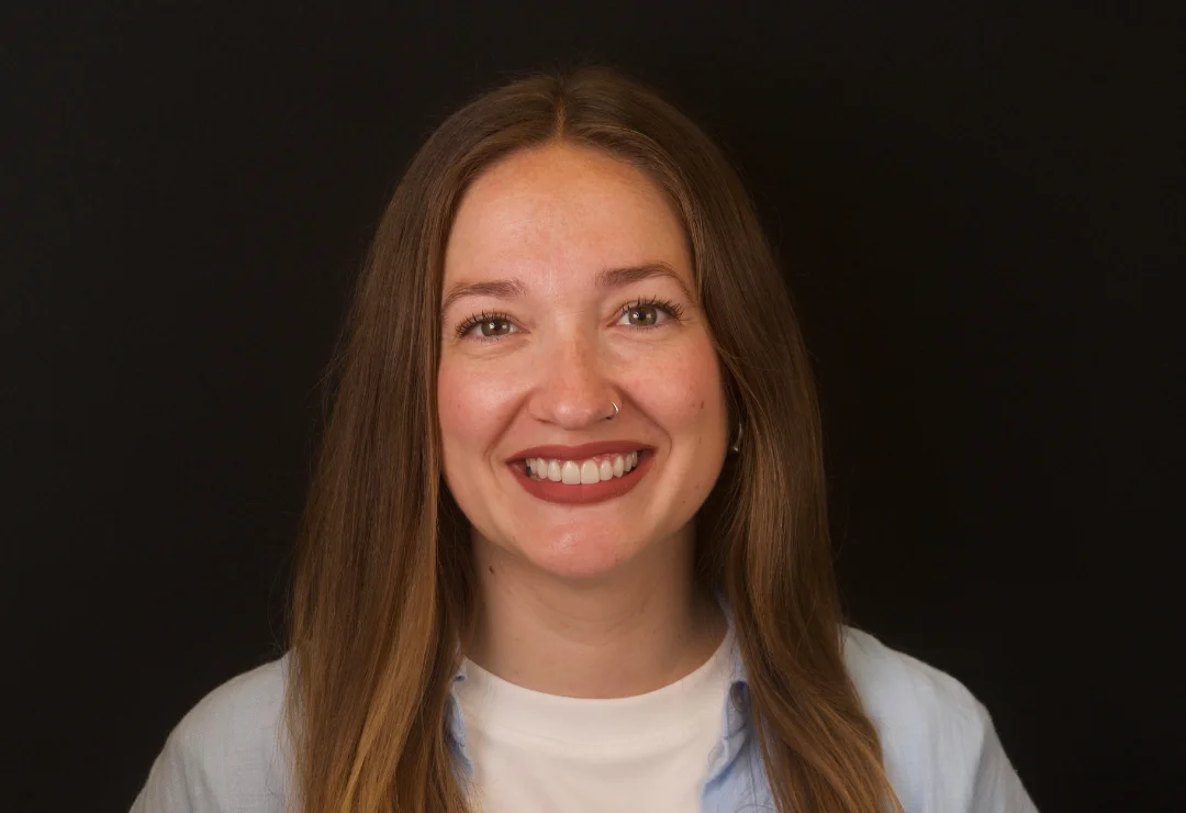 Carillas de Porcelana - Macarena 4 Carillas de Porcelana - Macarena 4