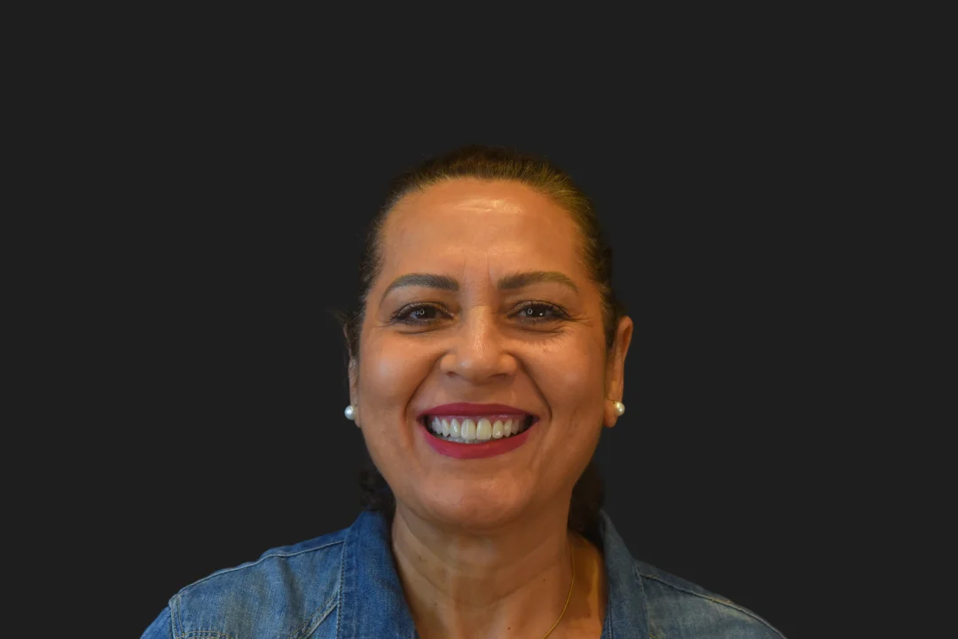 Carillas de Porcelana - Sonia 4 Carillas de Porcelana - Sonia 4