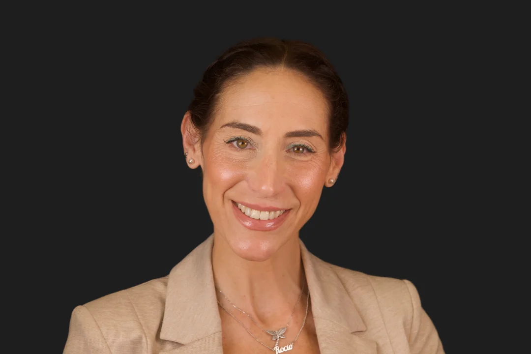 Carillas de Composite - Rocío 4 Carillas de Composite - Rocío 4