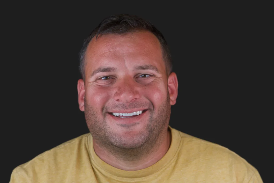 Carillas de Porcelana - José 4 Carillas de Porcelana - José 4